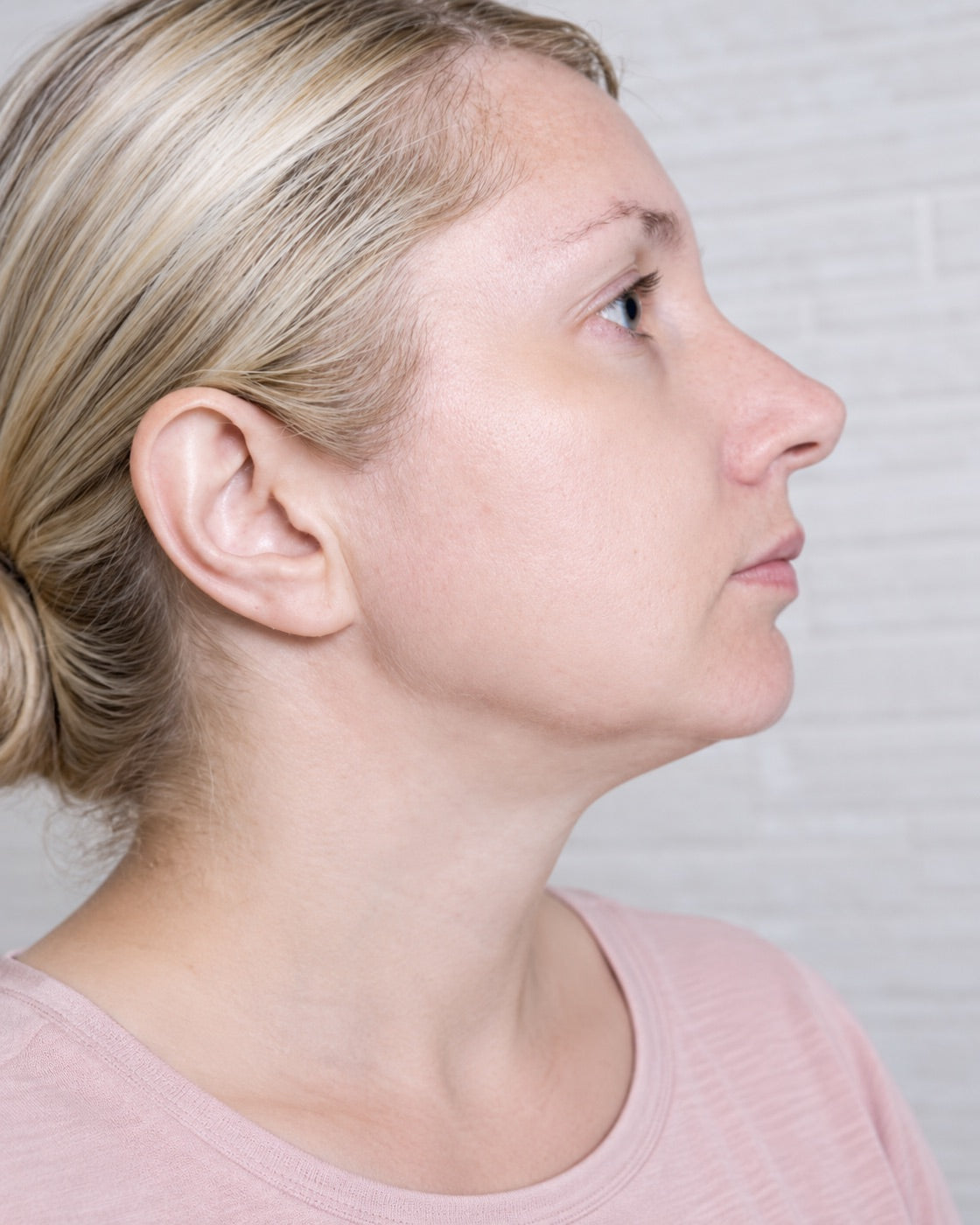 Redness & breakouts